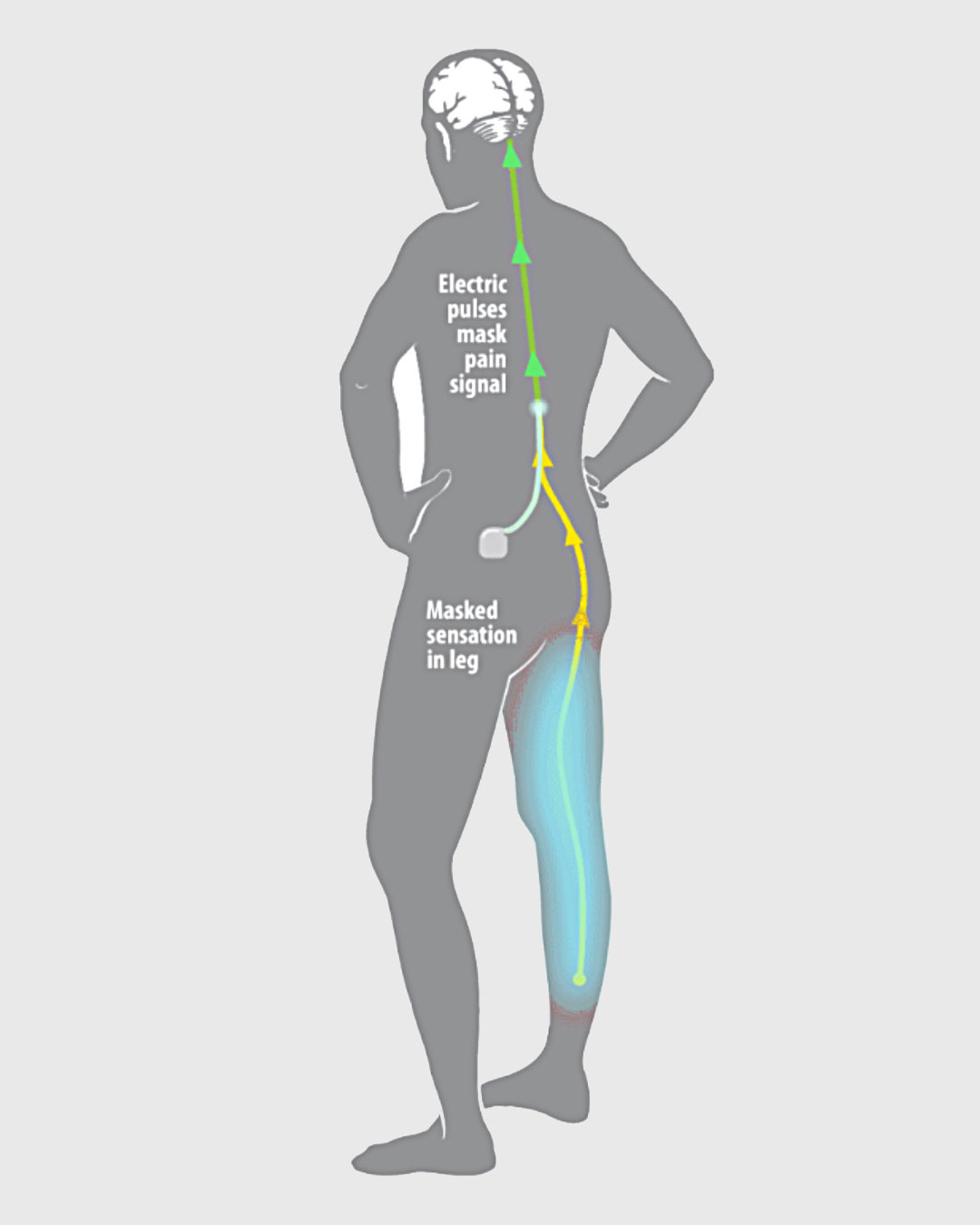 painful diabetic neuropathy